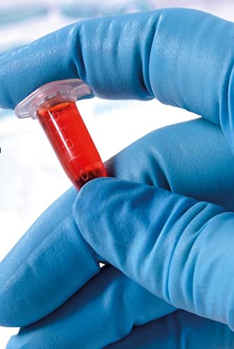 isolab-mikrozentrifugenr-hrchen-0-5-ml-500-st-ck-pp-konisch image 7